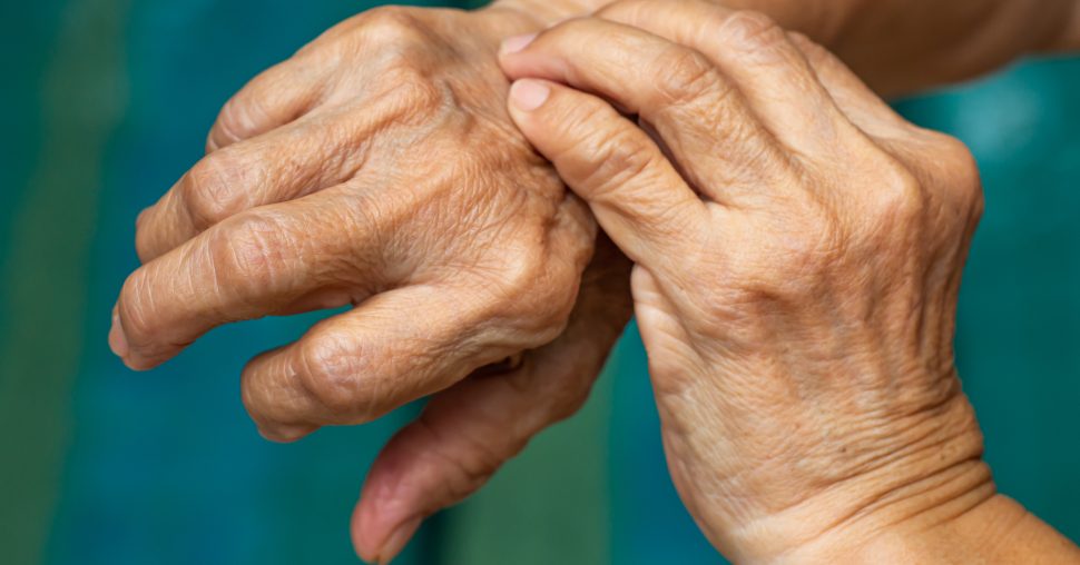 Jeukende huid bij ouder worden: wat niemand je vertelt